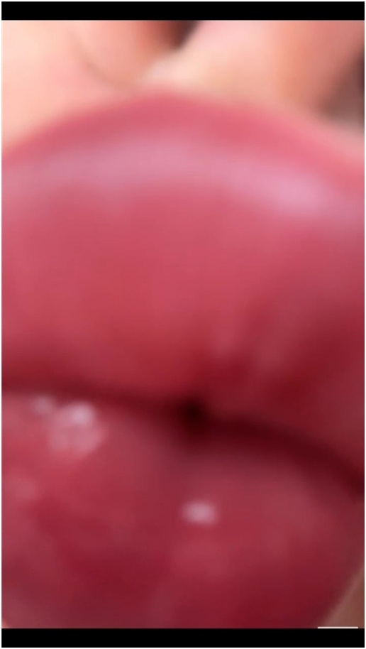 Yourhikerbabe – Kissing Attack
